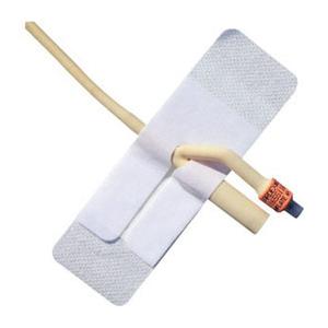 Adhesive Foley Catheter Anchoring Device