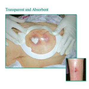 Tegaderm Clear Absorbent Acrylic Dressing 3" x 3-3/4" Oval