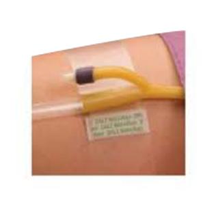 Hold-n-Place Foley Catheter Holder Adhesive Patch, One Size Fits All