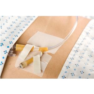 CATH-SECURE Dual Tab Multi-Purpose Tube Anchoring Device